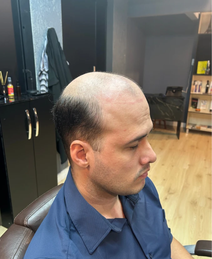 Antes da aplicação